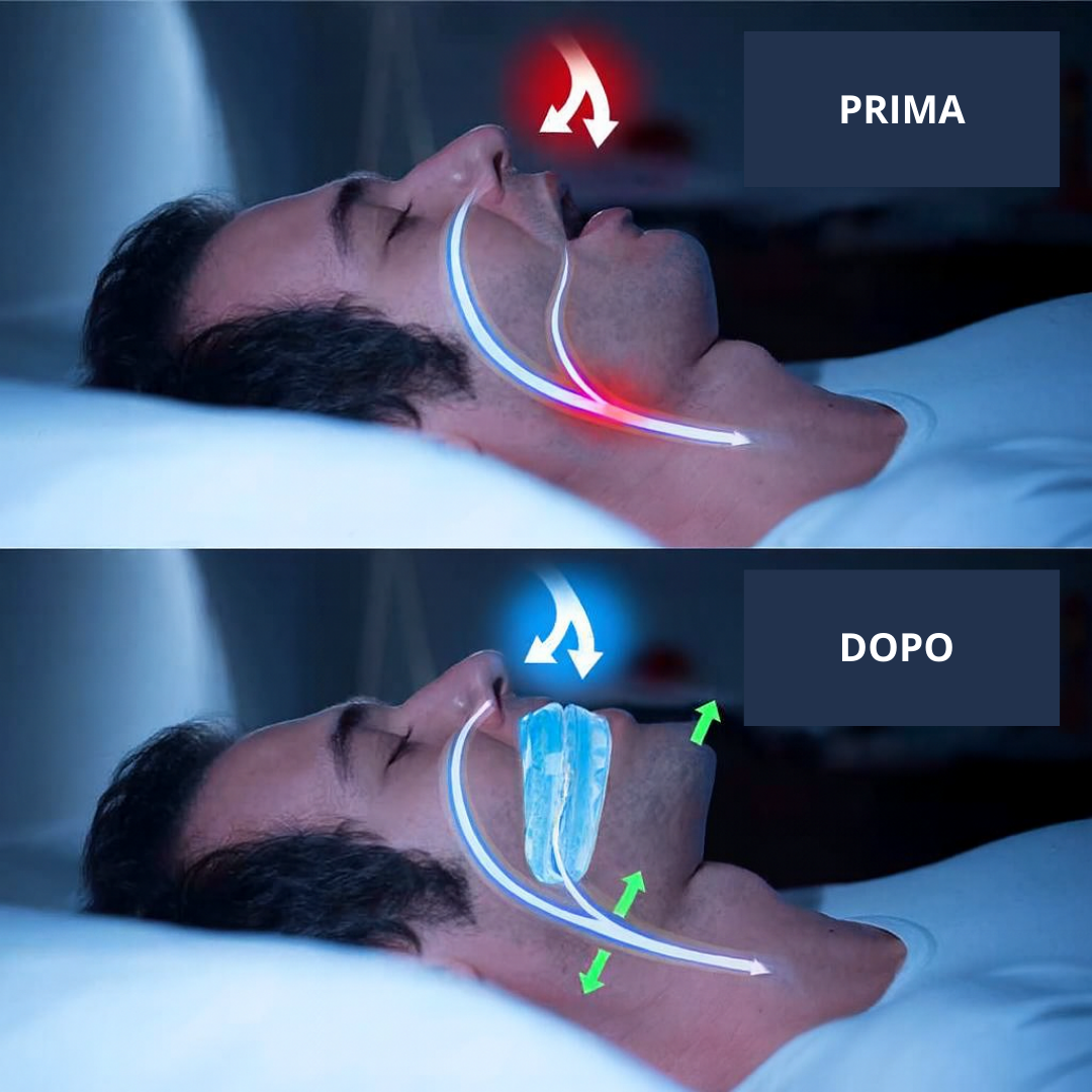 NexSleep SilentFit™