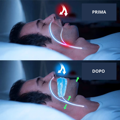 NexSleep SilentFit™